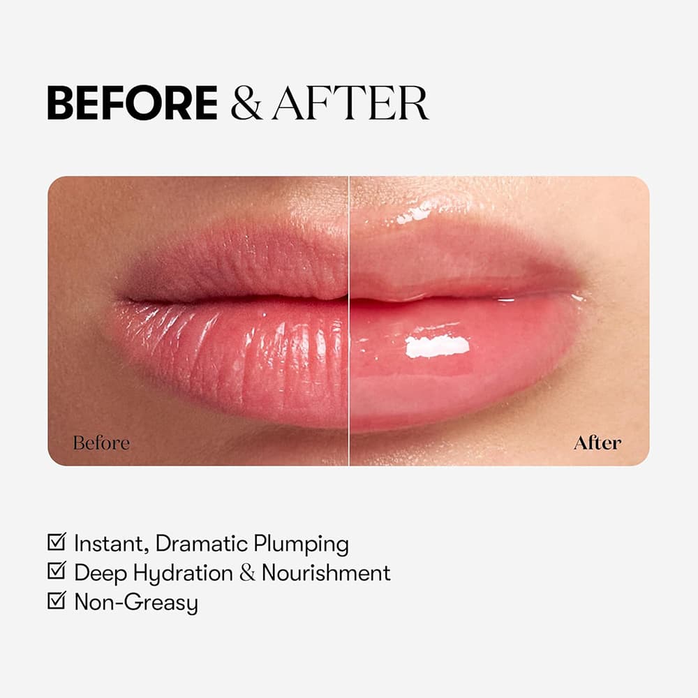 reedle-lip-plumper-expert-luciu-de-buze-volumizant-4-3-gr_30755_6_1762776303.jpg
